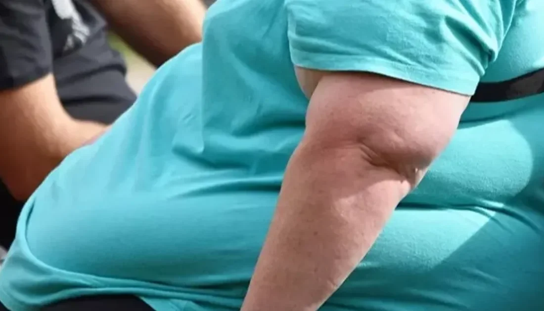 Obezite, kadınlarda hormonal değişiklikler,