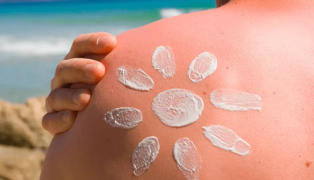 Dermatoloji Uzmanı Dr. Burcu