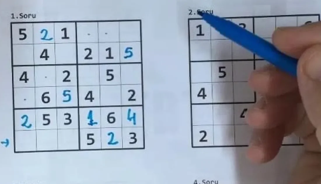 Nöroloji Uzmanı Prof. Dr.